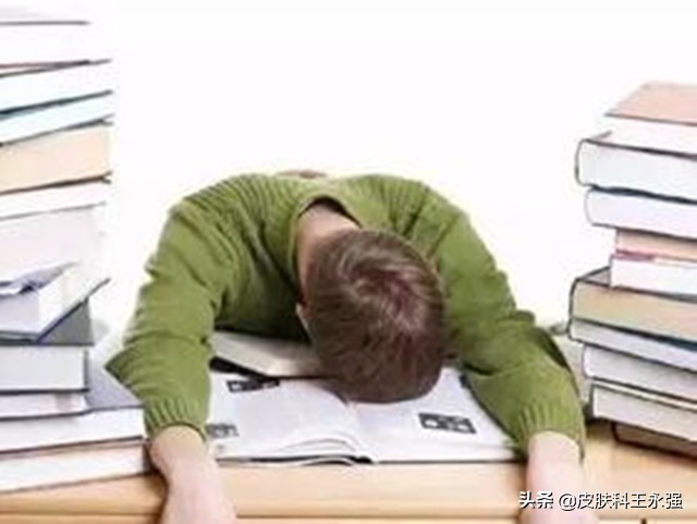 缠腰龙神经痛去医院挂什么科,缠腰龙疼得受不了怎么办