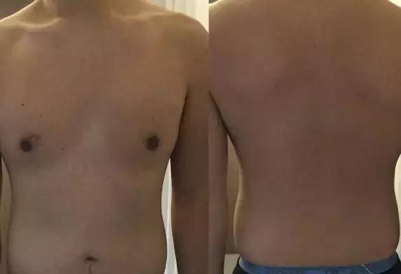 大量尿蛋白9克打单抗管用吗,尿蛋白9克多严重吗