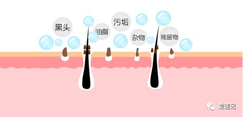 有这6个症状说明你的经络堵塞了,身体有5个征兆说明血管堵住了
