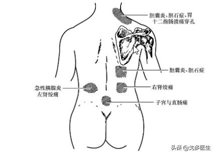 常见肚子疼的原因有哪些,最常见的肚子疼原因