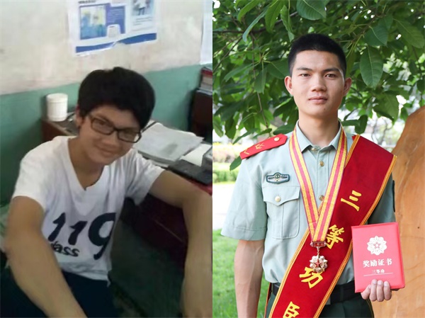 当兵前可以整容吗,当兵为什么要整容