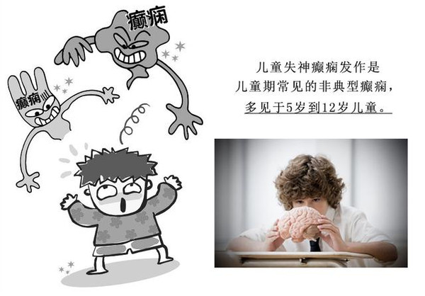 小孩癫痫抽搐有什么好的治疗办法,儿童癫痫发作时家长现场急救