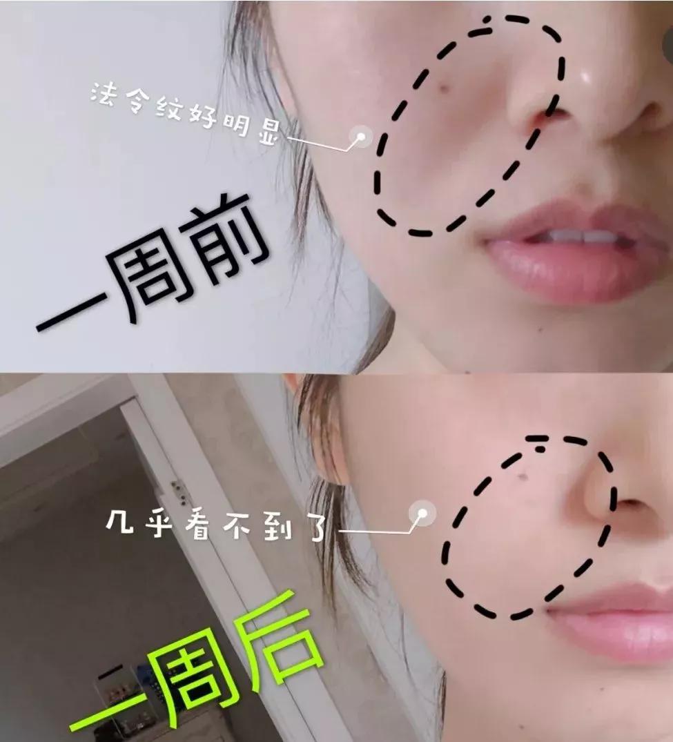 刘亦菲保养皮肤的方法,30岁皱纹多怎么修复