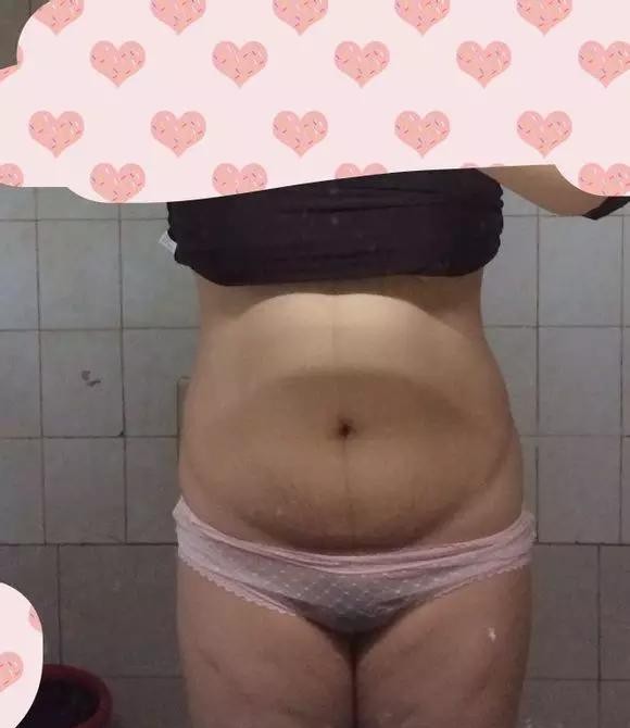 避免产后肥胖的最好方法,中医认为产后肥胖的原因是哪些