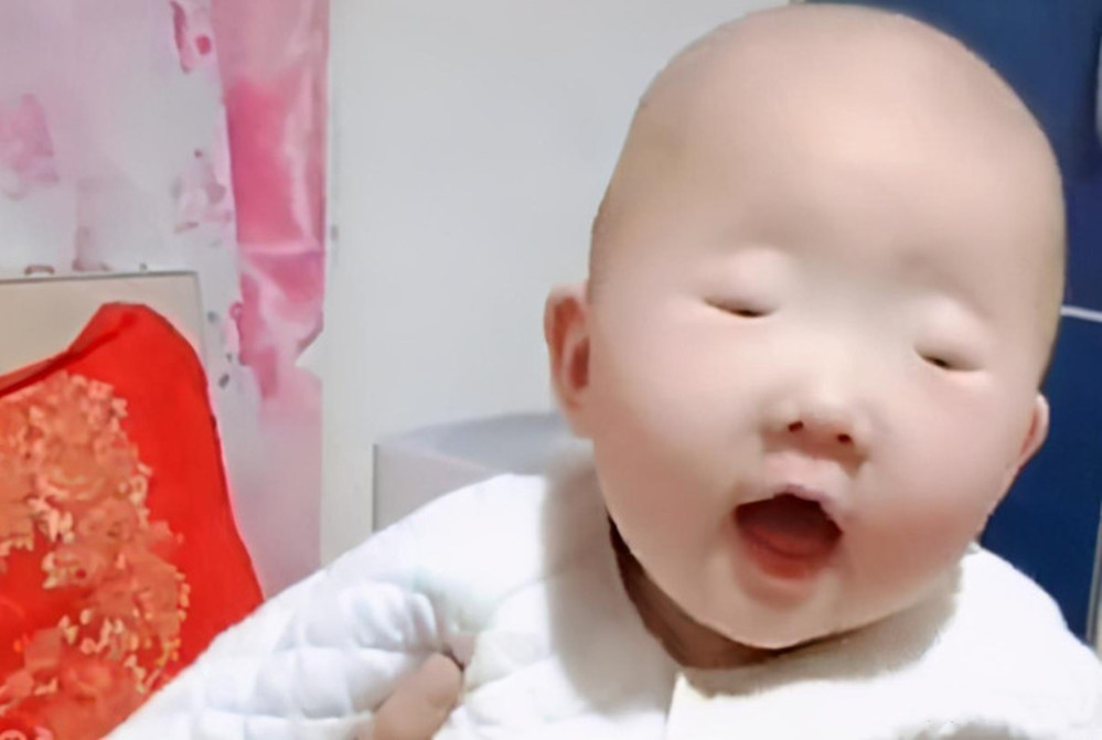 30天宝宝豆豆眼是什么原因造成的,宝宝长痘痘和妈妈饮食有关吗