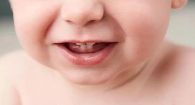 儿童长双排牙怎么让乳牙掉得更快,乳牙没掉新牙成双排牙