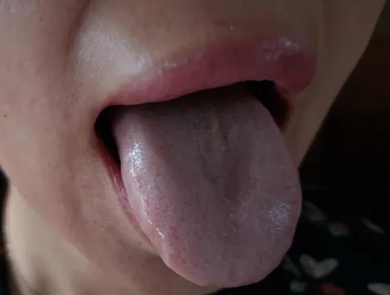 许家栋经典经方医案,许家栋经典经方治脾胃病