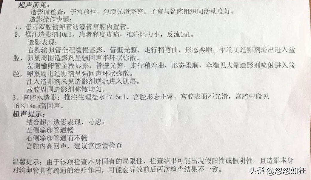 高龄备孕（四）：输卵管超声造影前问个傻问题，大夫一听笑了……