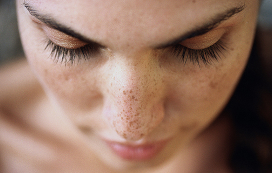 皮肤怎样淡斑,皮肤怎样补水淡斑