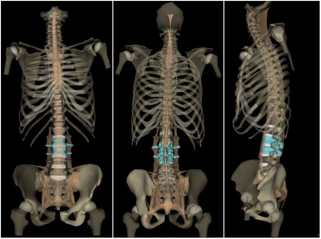 腰痛是不是肾不好引起的,腰痛原因弯不直腰