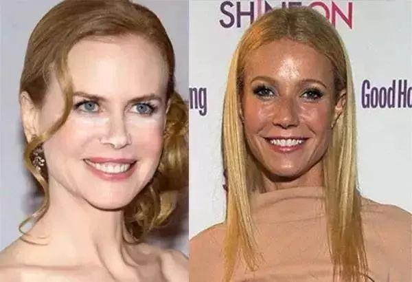 沈梦辰肤色多黑,沈梦辰为什么黑皮肤能化妆变白