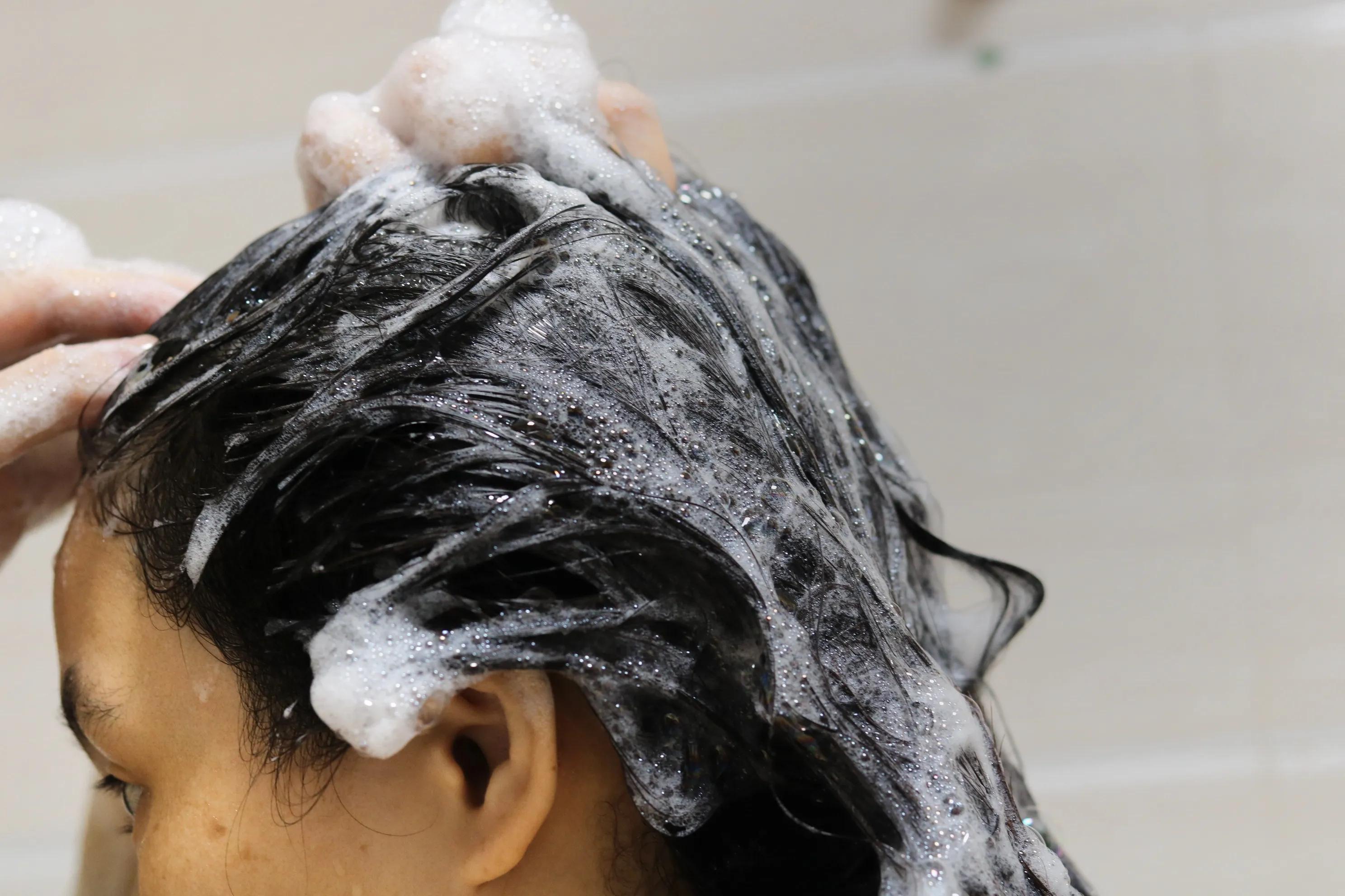 宝藏止痒洗发水,宝藏自动控油的蓬松洗发水