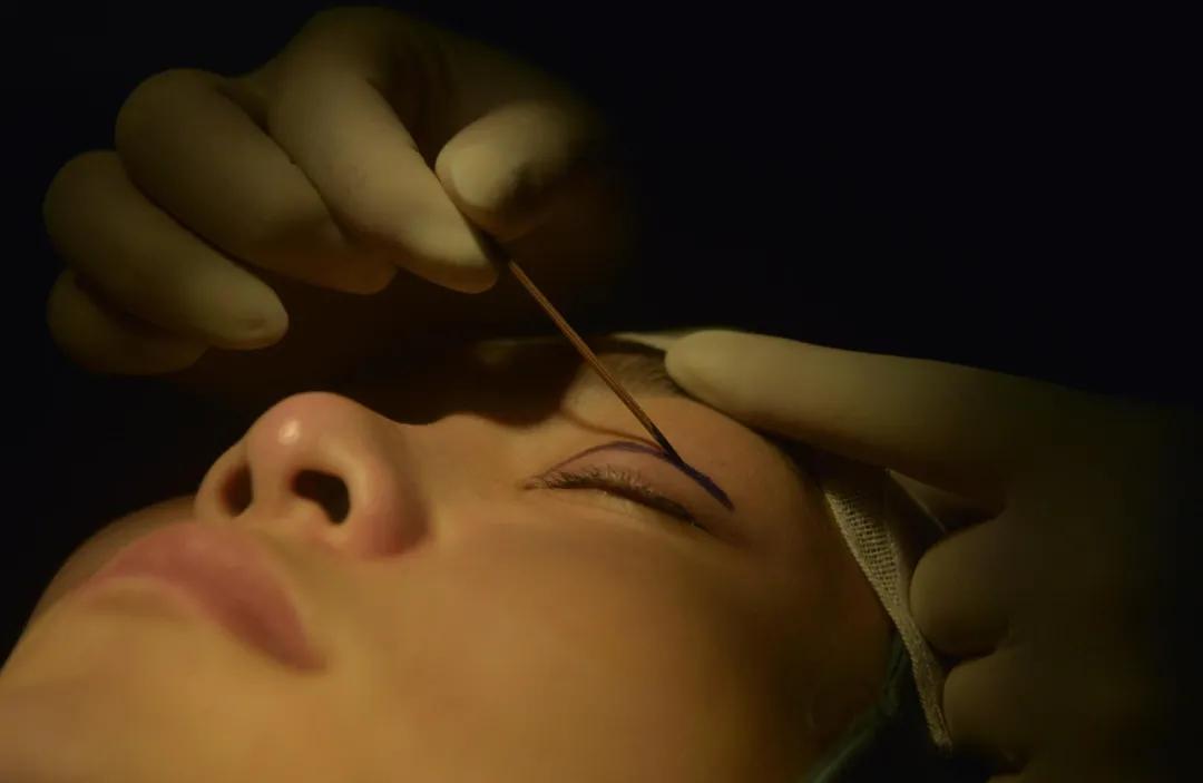 小作坊整容效果,在整容院上班的女人