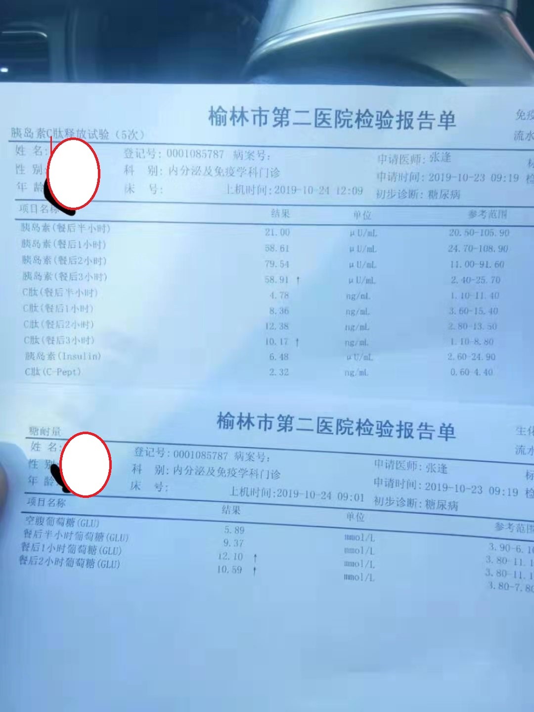 胰岛素延迟是胰岛素抵抗吗,胰岛素延迟和胰岛素抵抗区别