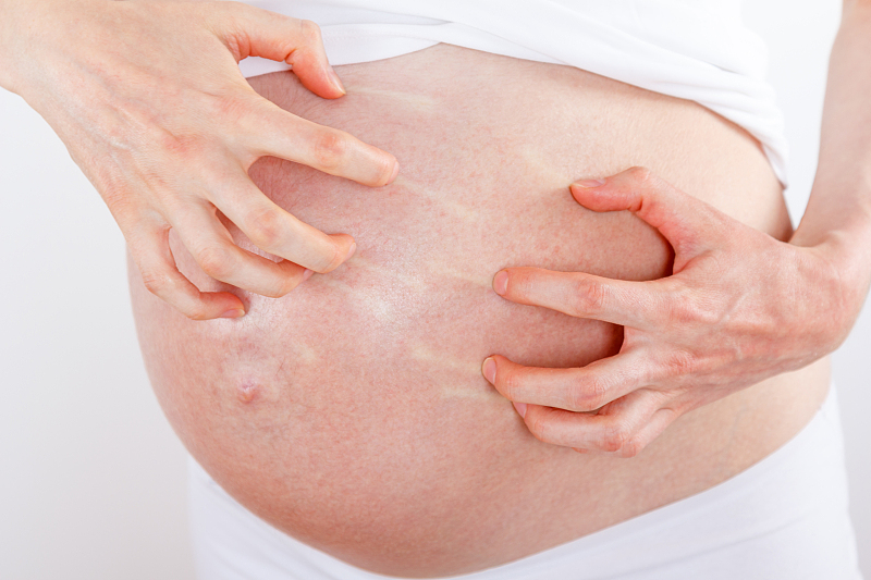 孕期皮肤瘙痒该看哪个科？