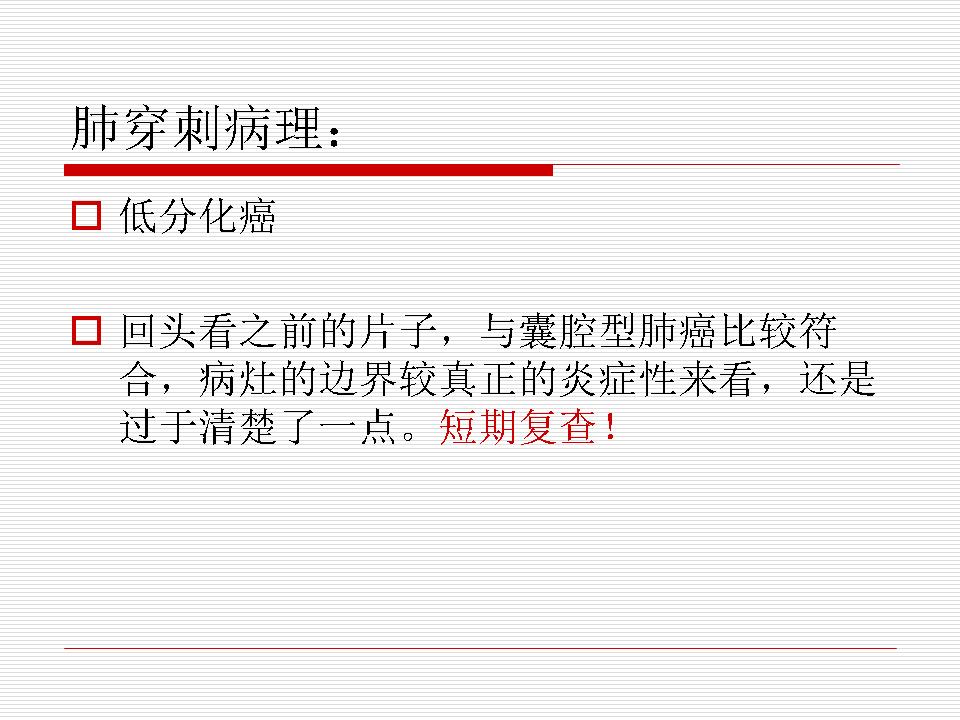 像炎症的肺癌能治好吗,医生说可能是肺癌也可能是炎症