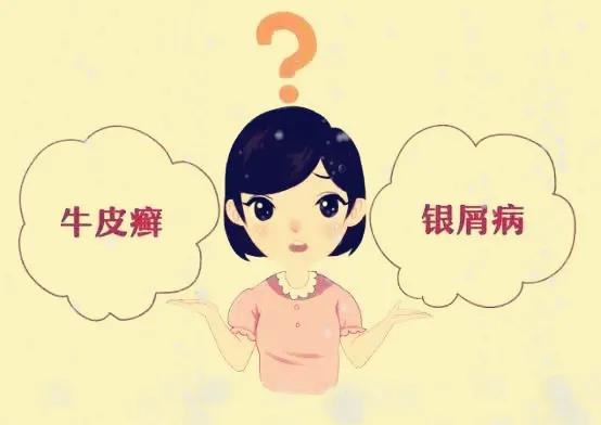 全身长满了牛皮癣属于重度吗,牛皮癣好了突然身上一堆小红疙瘩