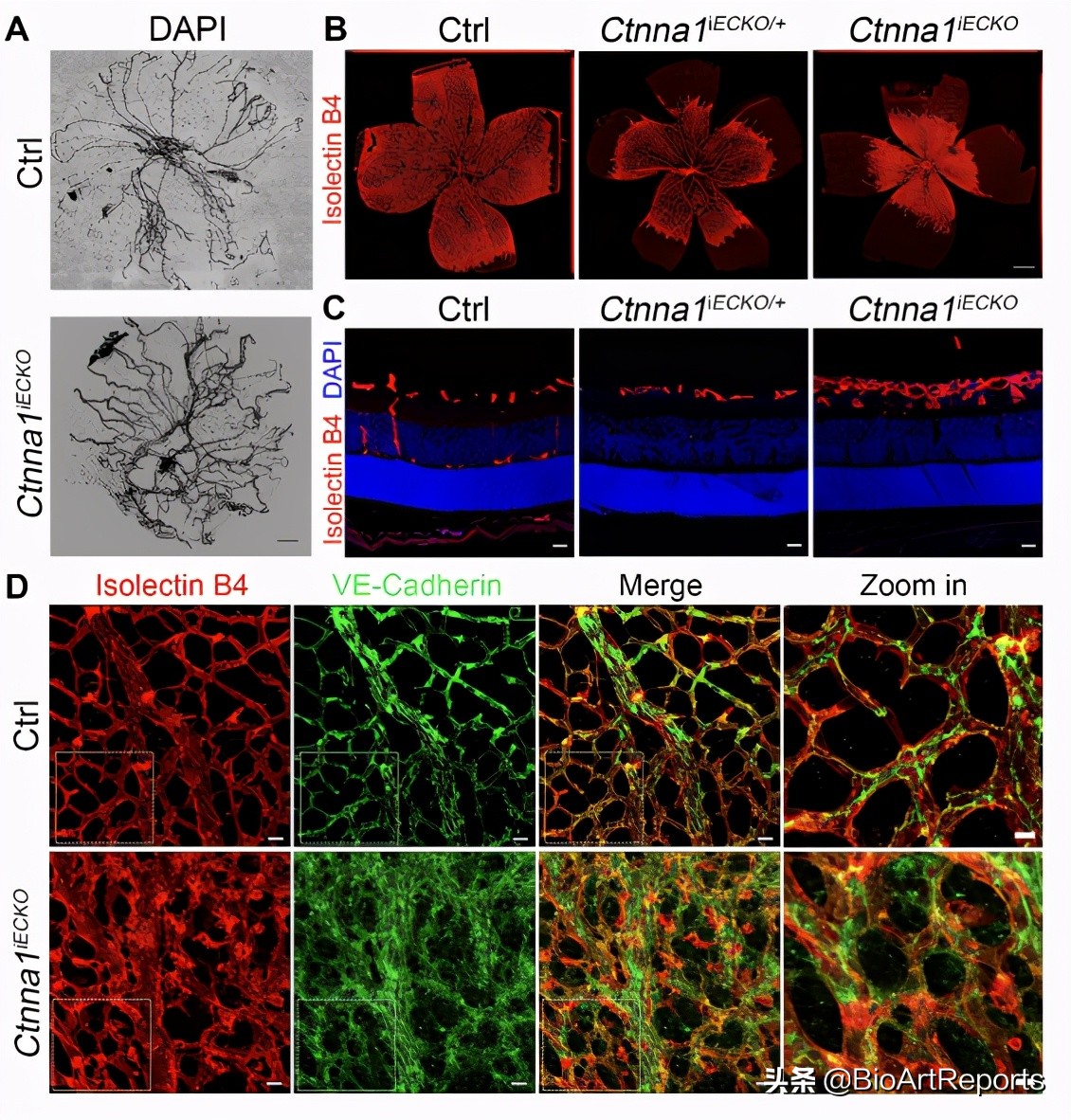 家族性视网膜病变是怎么回事,基因治疗视网膜病变最新进展