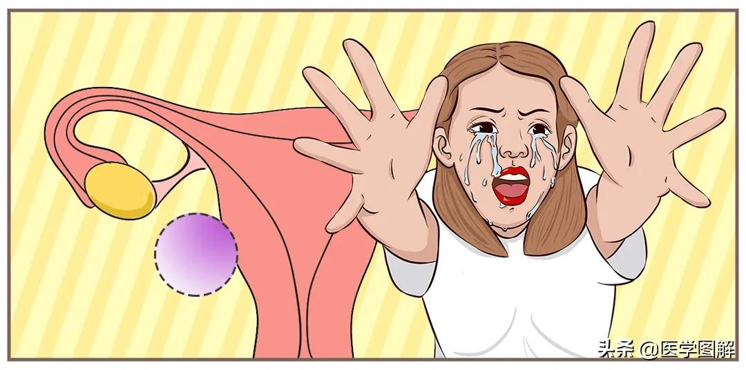 子宫肌瘤，比你想象的可怕！瞬间就危在旦夕？丨医学图解