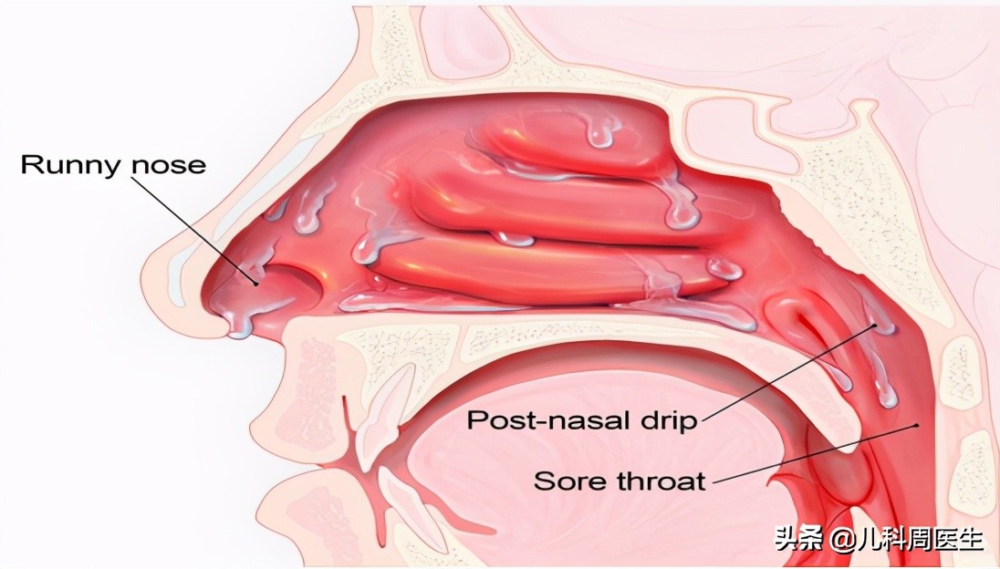 鼻涕有什么秘密,鼻涕的隐藏含义