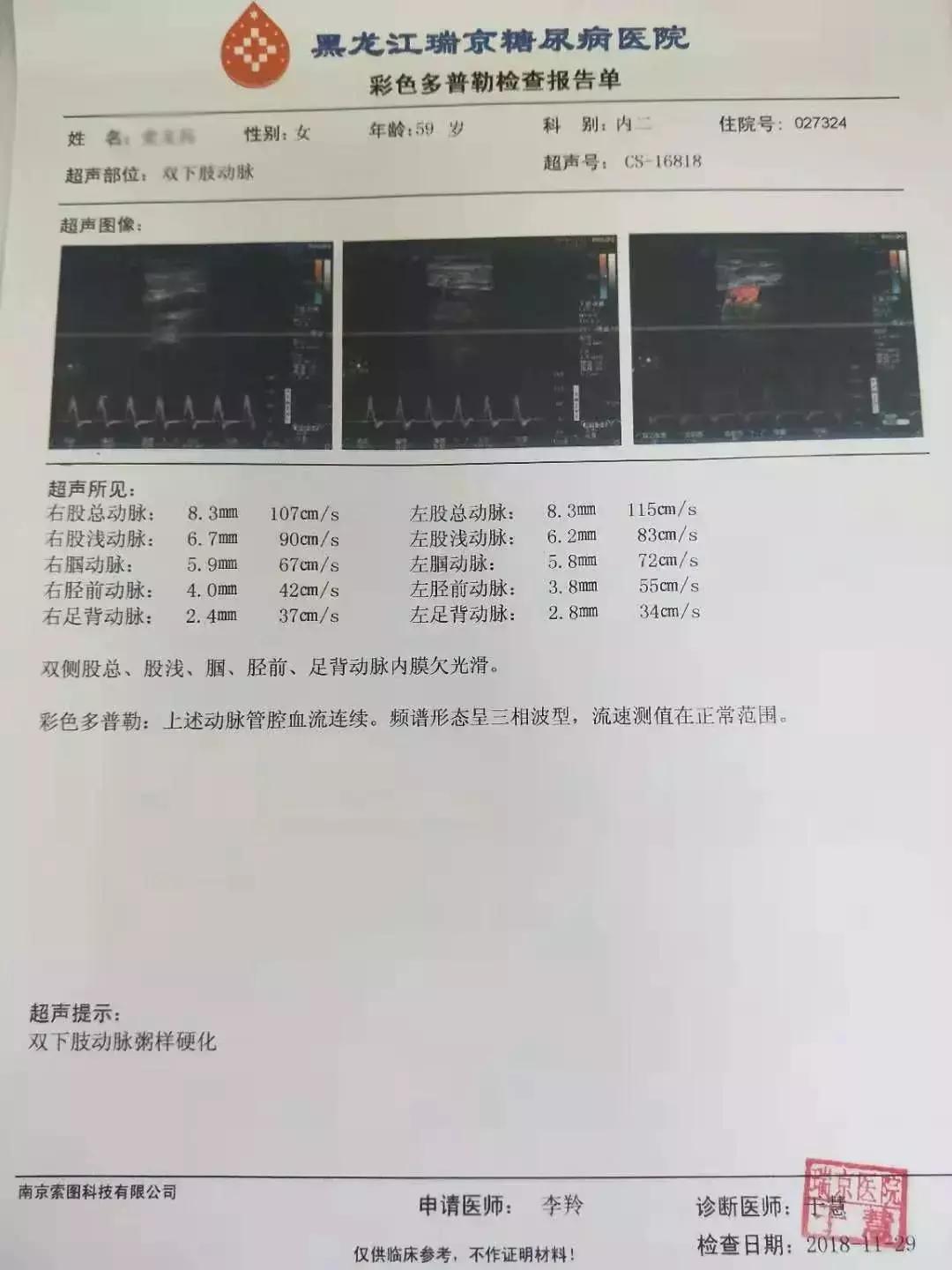 肥胖引起二型糖尿病用吃药吗,糖尿病联合用药方案
