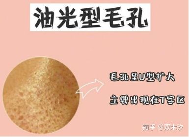 几种类型毛孔粗大改善的方法,毛孔粗大如何用科学方法改变