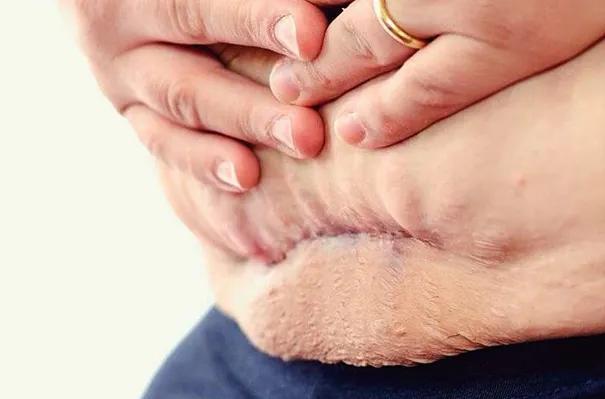 拿什么拯救你我的快乐,拿什么拯救你我身上的疤痕