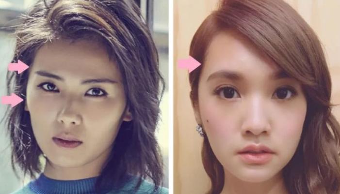 颧骨高太阳穴凹陷卷发,高颧骨太阳穴凹陷卷发