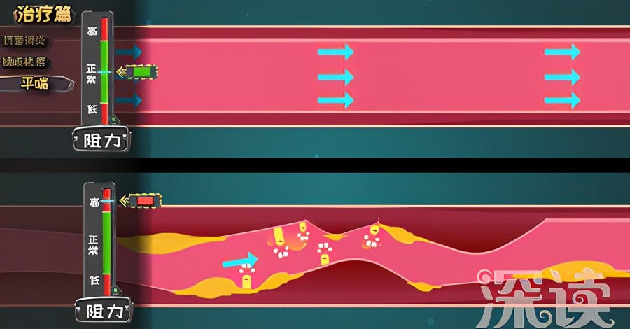 治气管炎的动漫,气管炎科普动漫