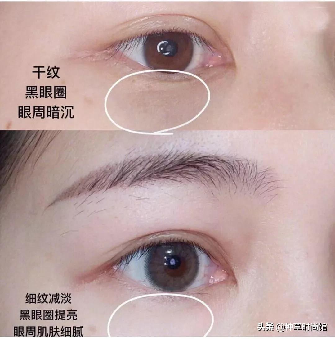 你的眼膜上白名单了吗？