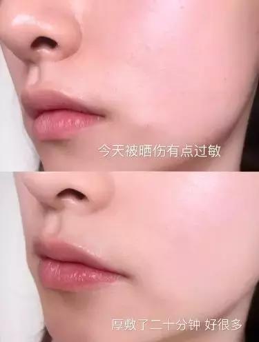 军训后要被晒成碳？史上最强晒后修复攻略，让你快速白回来