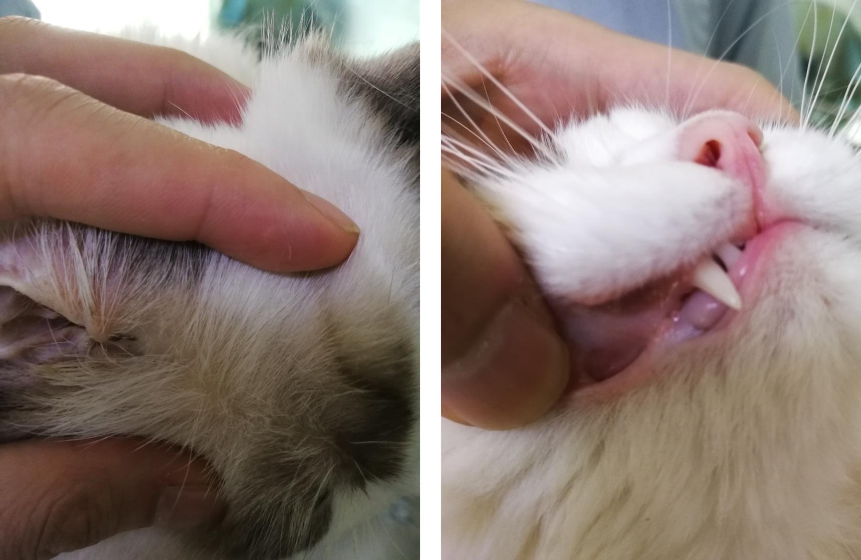 一招逆转脂肪肝,健康脂肪肝一个方子就解决