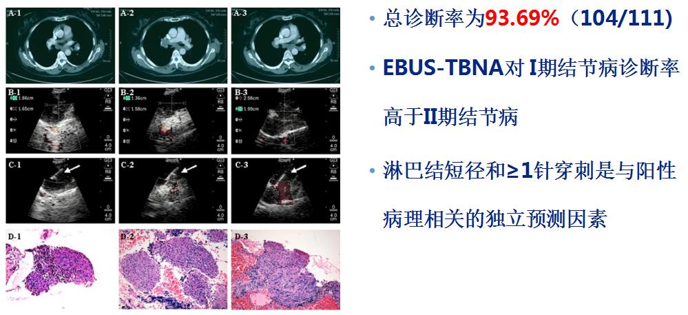 孙加源门诊,治疗肺癌的新技术新手段