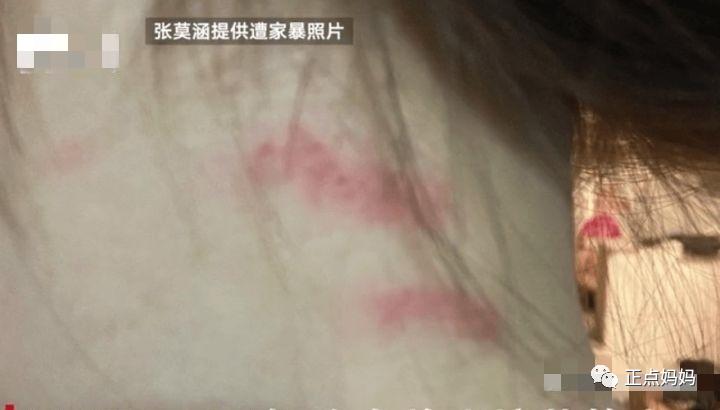 张漠寒自曝被家暴视频,张漠寒家暴