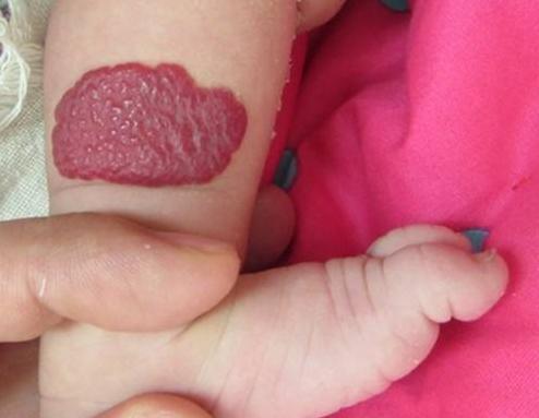 刚出生的宝宝哪21种情况不是病,刚出生的婴儿会出现什么症状