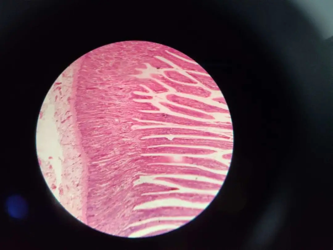 医学生学习打卡做题,医学生学习成果检验视频