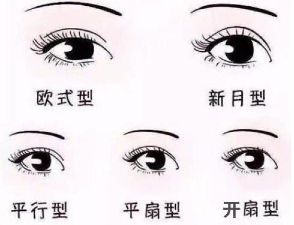 双眼皮手术详细教程,埋线双眼皮手术全过程