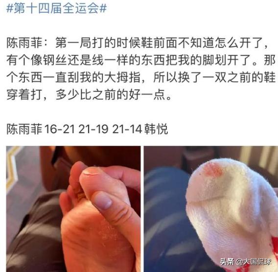 李宁比赛被运动鞋割伤,李宁鞋奥运会摔倒事件
