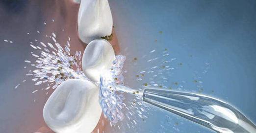 口腔护理牙缝清洁,牙缝清洁是每个牙缝都要清洁吗