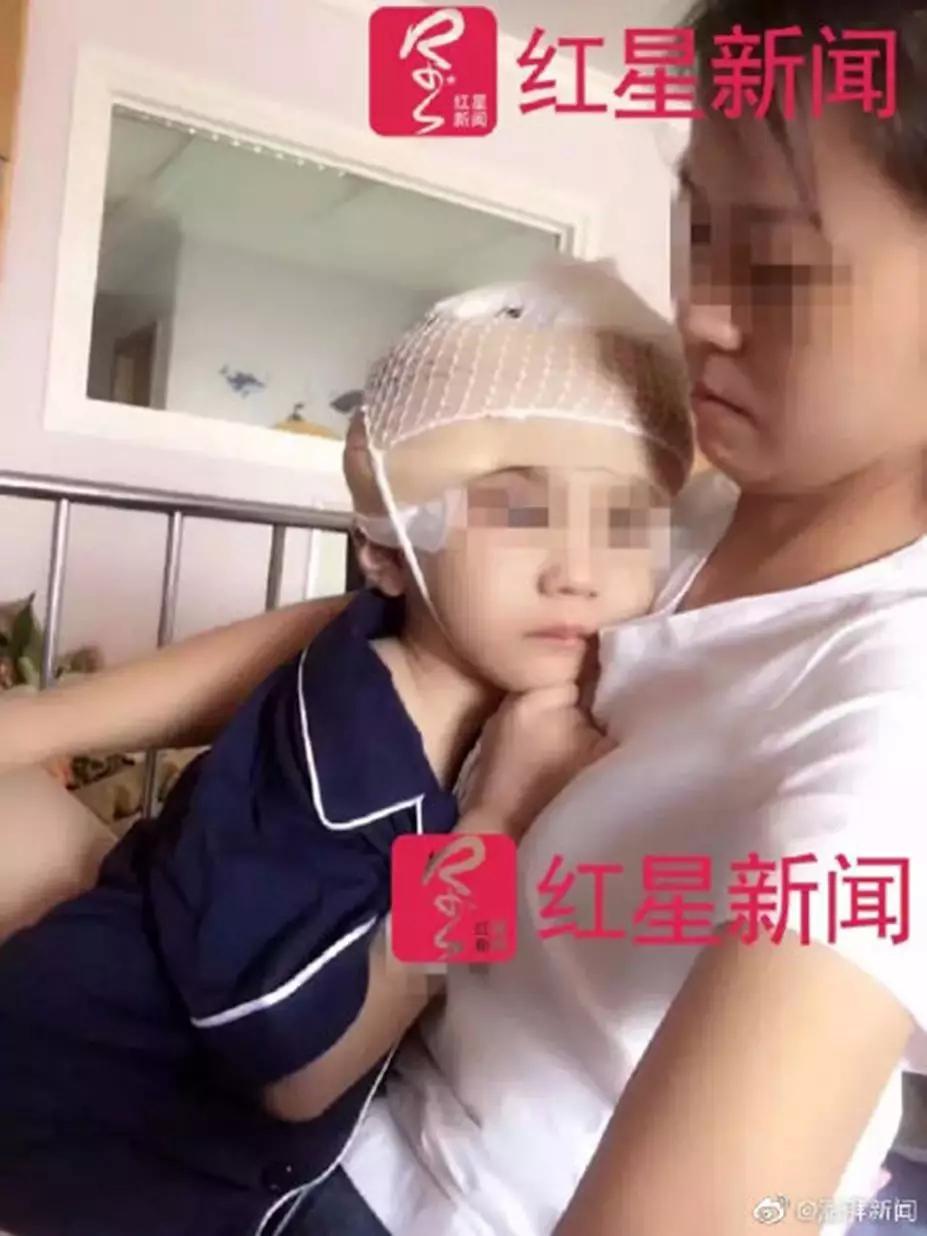 男童被继母虐待成植物人,生父被以虐待罪及遗弃罪起诉