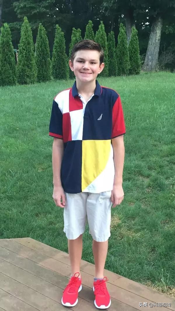 大脑被切除三分之二,左脑切除了还能自理吗