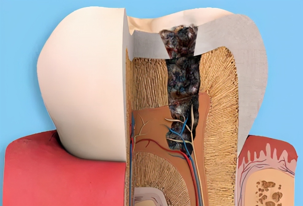 上海雅悦齿科,雅悦齿科种植牙