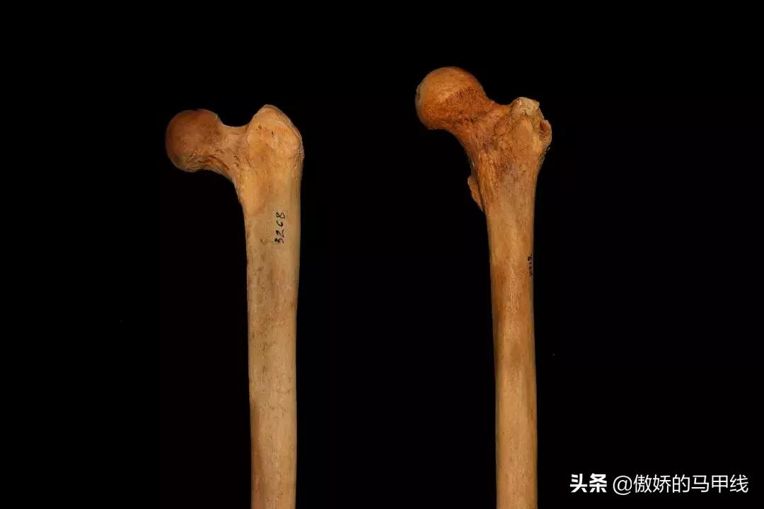 深蹲屁股眨眼如何改善,深蹲屁股眨眼正确吗