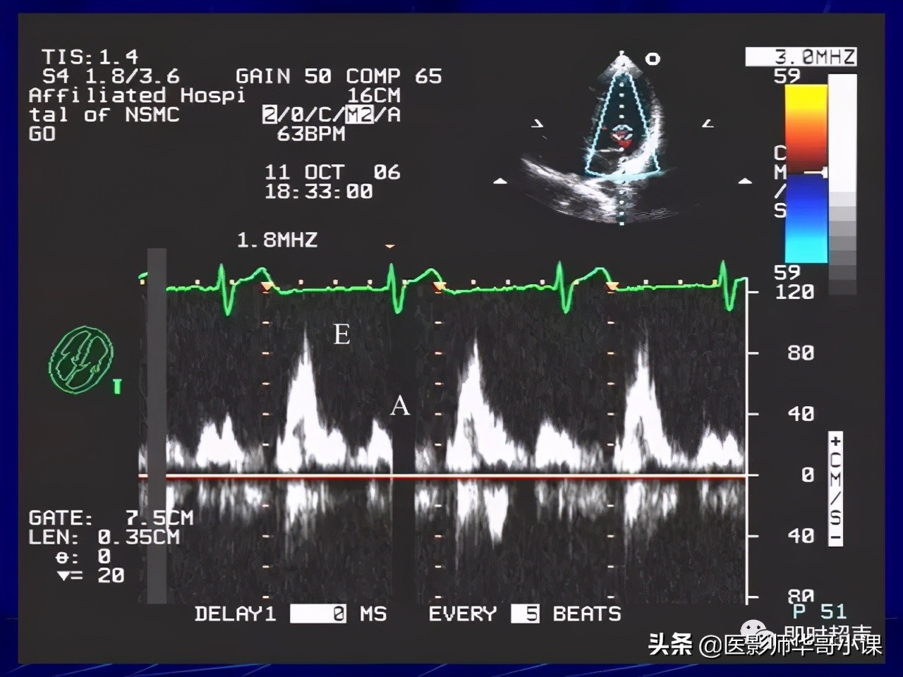超声检查报告单讲解,超声图像检查