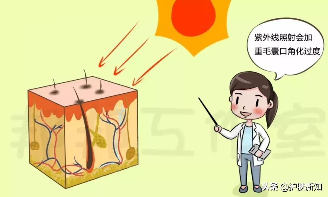 痘疮怎么消除,痘疮怎么治才能除根