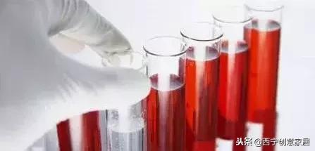 青海艾滋病最新数据,艾滋病查的是抗体吗