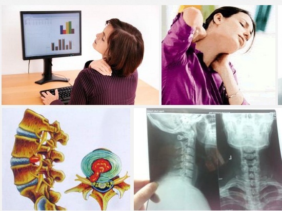 如何缓解颈部疼痛和僵硬,如何缓解颈部的症状