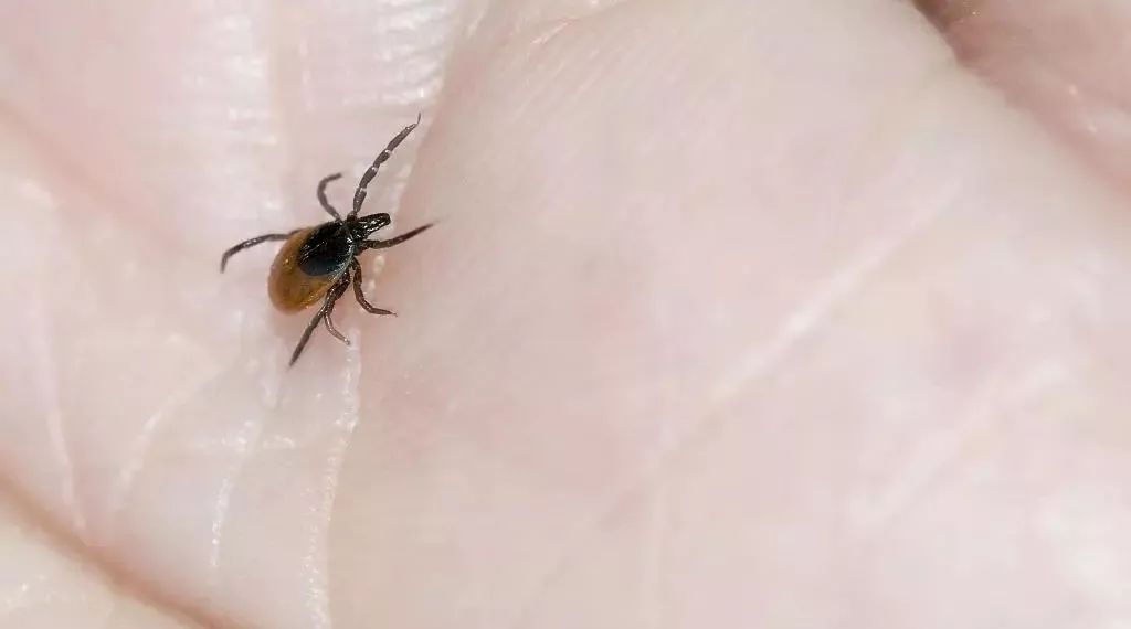 被蚊子咬了什么症状是得病了,被蚊子咬了出现的症状和解决方法