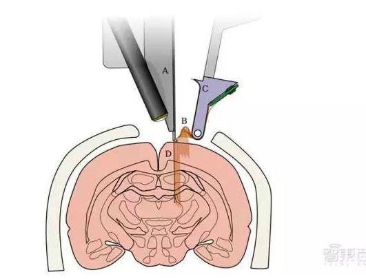 打孔埋线,一步搞定!马斯克的“赛博格”变身方案来了