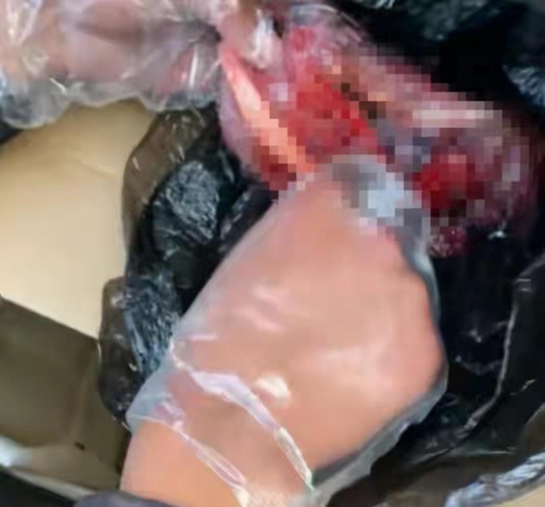 人体胎盘能吃吗有啥作用,人体胎盘能吃吗有什么作用